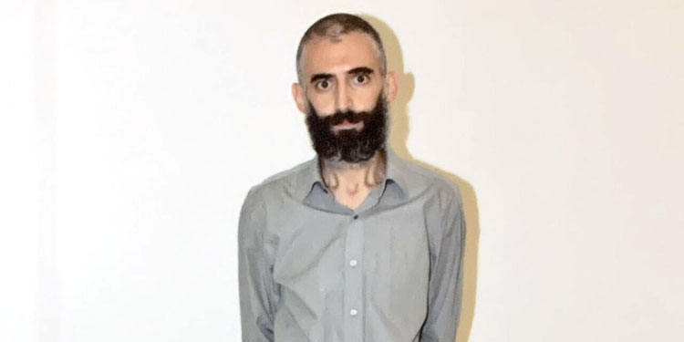Kuyu Tipi Cezaevlerine Karşı 266 Gün Açlık Grevi Yapan Gürkan Türkoğlu Yaşamını Yitirdi